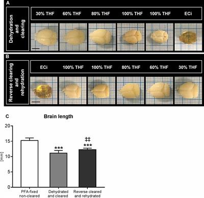Light Sheet Microscopy Using FITC-Albumin Followed by Immunohistochemistry of the Same Rehydrated Brains Reveals Ischemic Brain Injury and Early Microvascular Remodeling